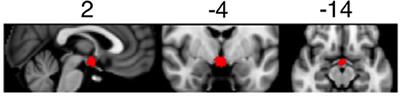 Imaging Individual Differences in the Response of the Human Suprachiasmatic Area to Light